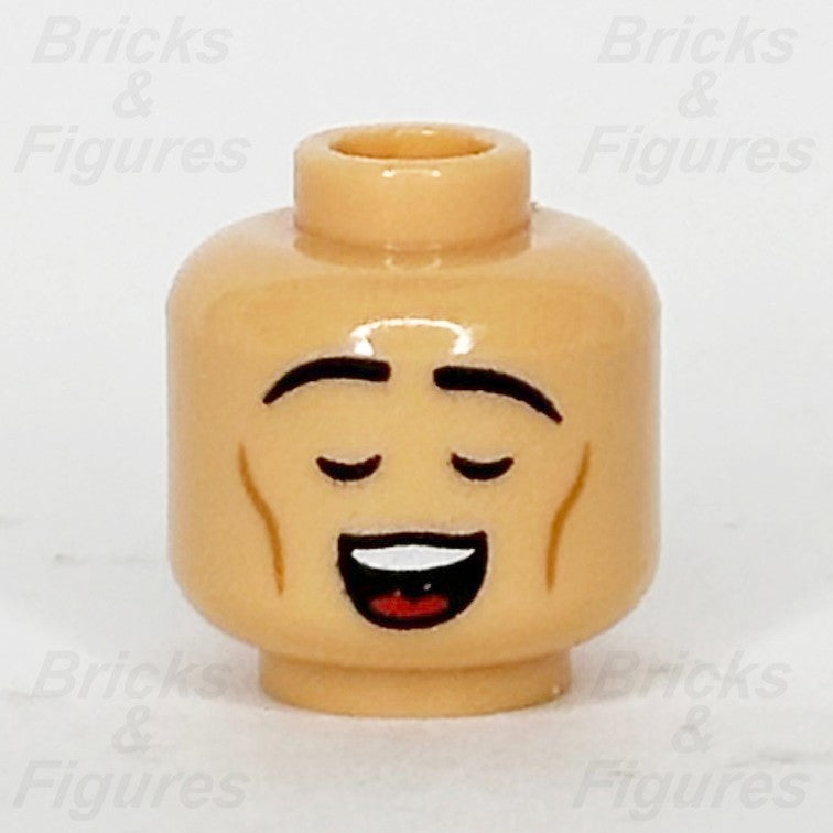 epi