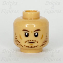 epi