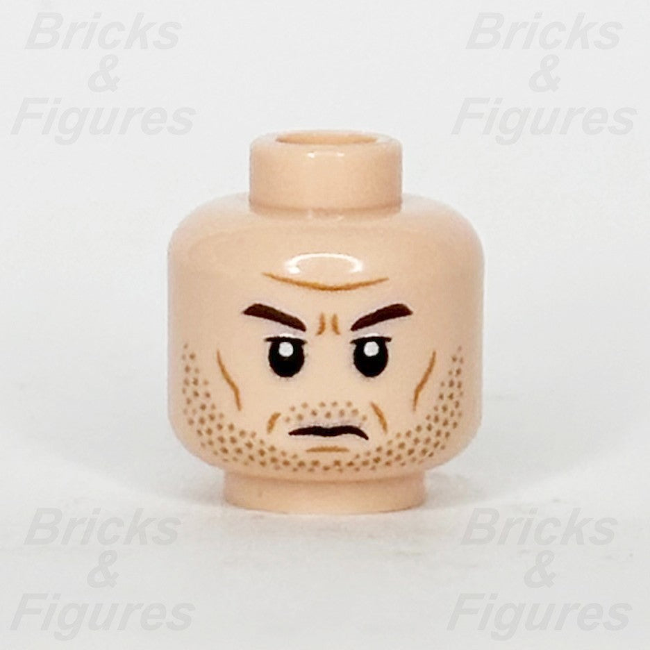 epi